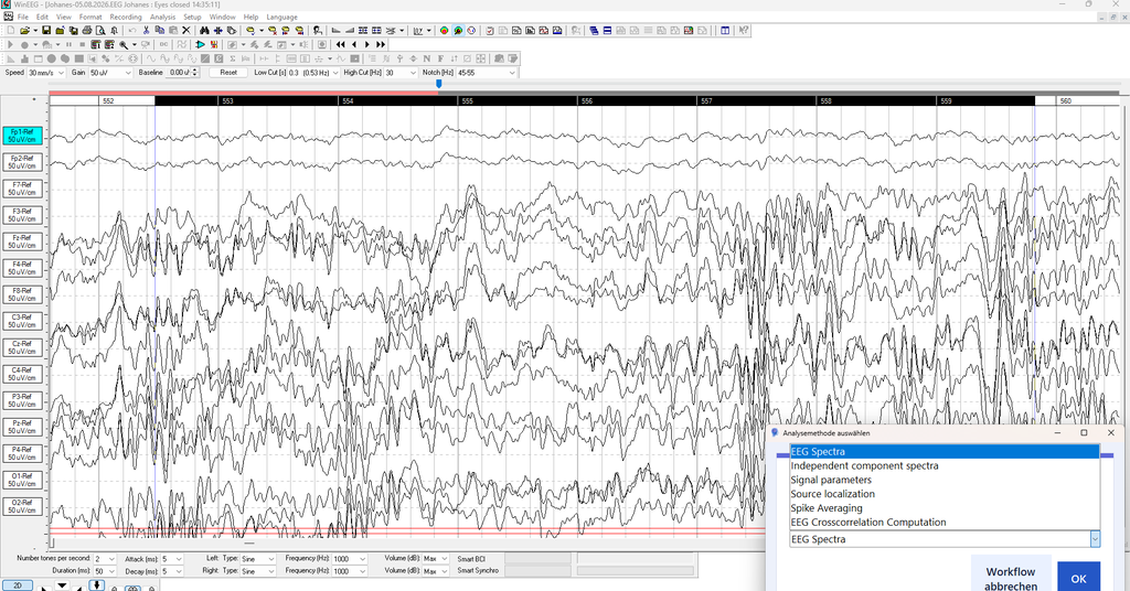 MediLauncher für QEEG-Software [WinEEG-Overlay]