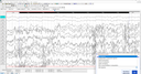 MediLauncher für QEEG-Software [WinEEG-Overlay]