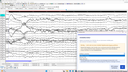 MediLauncher für QEEG-Software [WinEEG-Overlay]