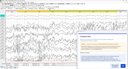 MediLauncher für QEEG-Software [WinEEG-Overlay]