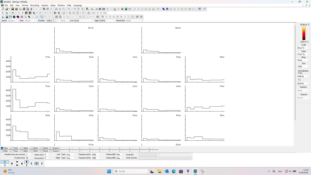 MediLauncher für QEEG-Software [WinEEG-Overlay]