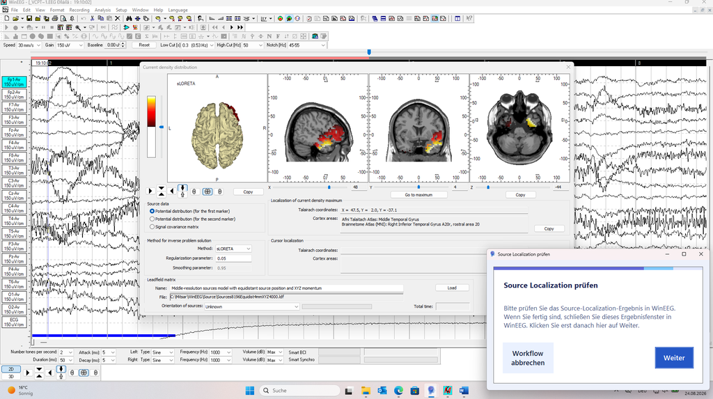 MediLauncher für QEEG-Software [WinEEG-Overlay]