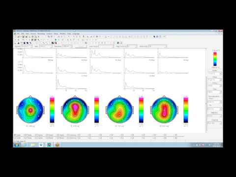 WinEEG Instructional Video | Jay Gunkelman & Cynthia Kerson