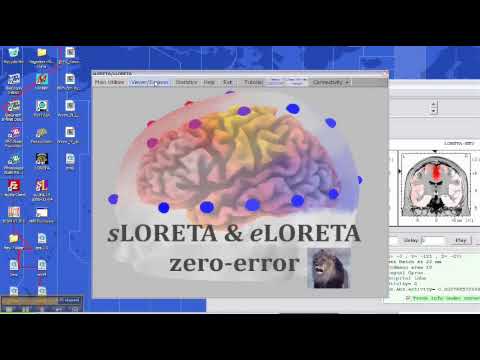 ICA and LORETA in WinEEG