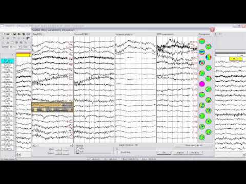 WinEEG education video  Part 1